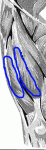 thigh_injection.gif