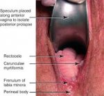 vagina.jpg