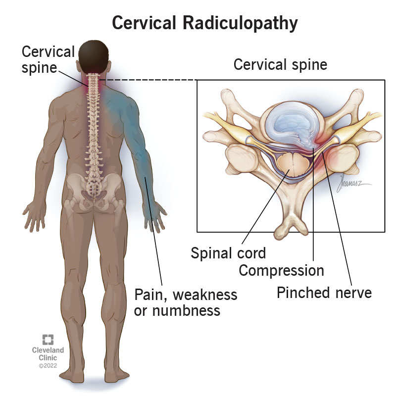 my.clevelandclinic.org